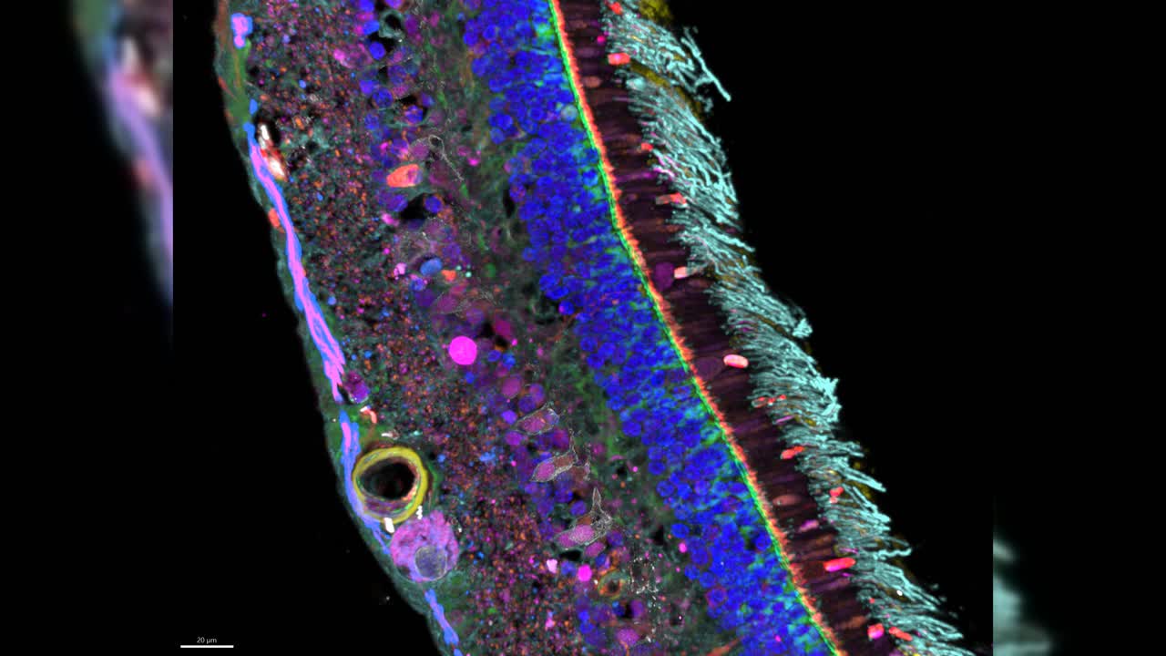 A Rainbow in the Eye: The Landscape of Retina