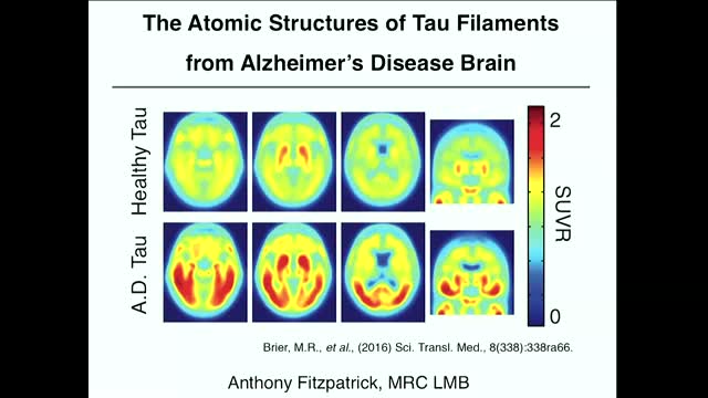 - Atomic Structures of Tau Filaments from Alzheimer's Disease Brain